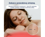 Zent Maska LED DermaLight - 1568670 - zdjęcie 8
